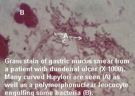 Helicobacter pylori is a spiral-shaped, Gram-negative rod approximately 0.5 x 3.0 micrometers in size.