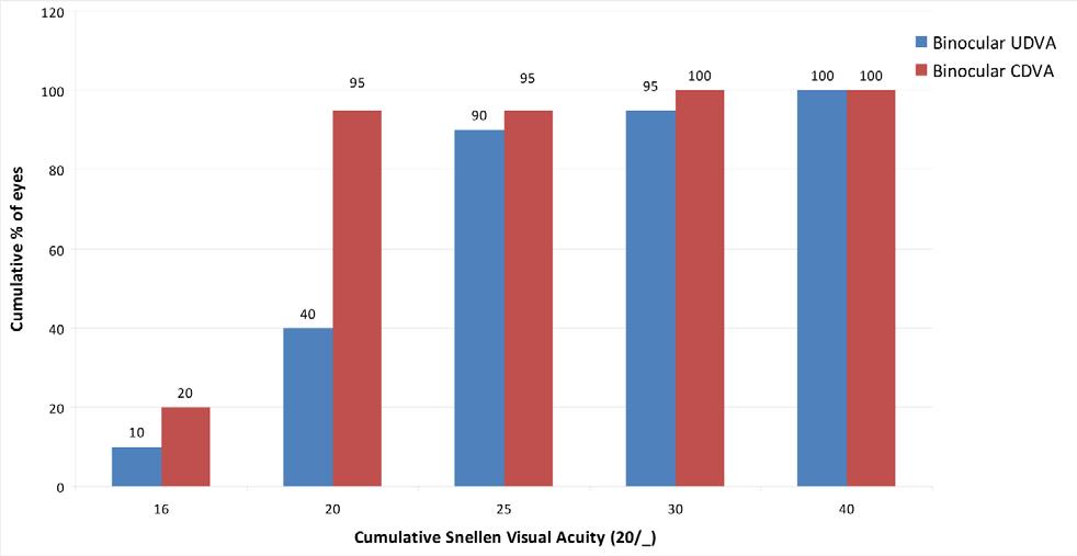 Figure 1. Cumulative bar graph for binocular distance visual acuity at 6 months after cataract surgery. UDVA = uncorrected distance visual acuity; CDVA = corrected distance visual acuity Figure 2.