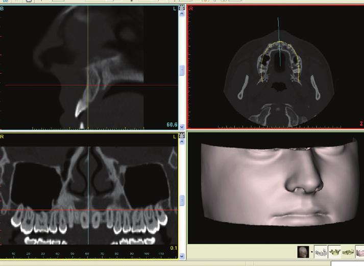 practices have installed CBCT scanners and a number of websites are available to assist in finding a suitable imaging centre.