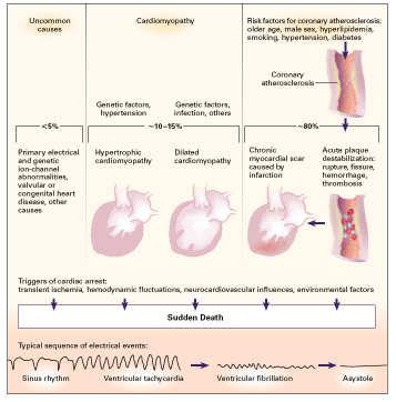 Primary Electrical Diseases: Normal Heart SCD can often be the first catastrophic manifestation of disease Syncope is an important risk factor Suspect arrhythmic cause when: sudden collapse without