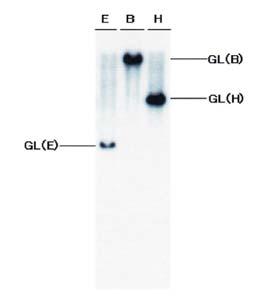 Yoshioka Y, et al. Fig. 4. Southern blot analysis of the patient s leukemic cells regarding T-cell receptor (TCR) gene rearrangement (performed by LSI Medience Corporation, Tokyo, Japan).