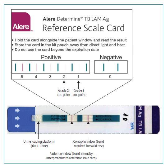 9.0 Interpretation of test results To assist with results reading and interpretation, use the reference scale card (provided in the kit) by holding it alongside the patient window.