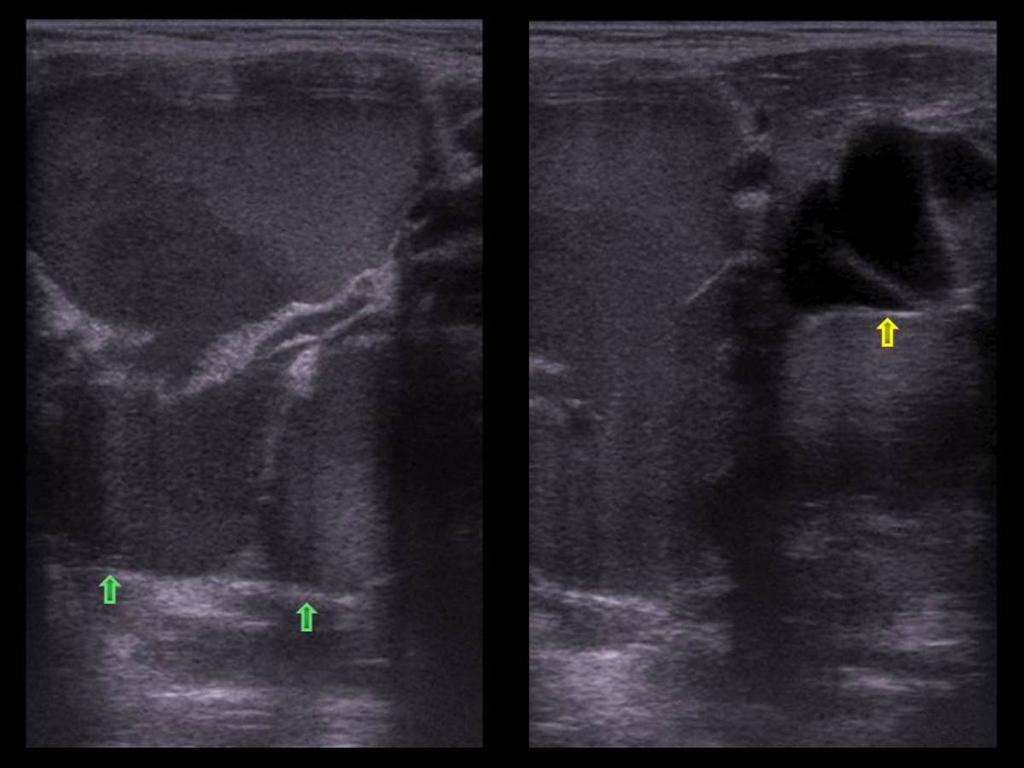 Fig. 2: Grey-scale ultrasound images of a