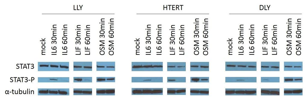 HMVEC-dLy (DLY), HMVEC-LLy (LLY) and htert-hdlec (HTERT) cells.