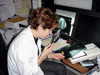 Computer-Aided Diagnosis (CAD) A large number of routine mammography is performed each year but the number of the specialist fails to keep up with demand.