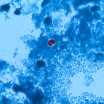 13-K (All Parasites) Results of Participating Laboratories Correct identification: Cryptosporidium sp.