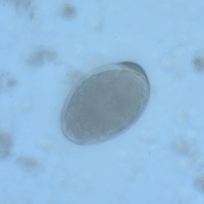 13-L (Helminths Only) Correct identification: Diphyllobothrium latum Results of Participating Laboratories Diphyllobothrium latum 99/100 99 10/10 Correct Dientamoeba fragilis 1 1 0 Incorrect No