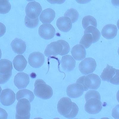 Results of Participating Laboratories 13-O (All Parasites) Correct identification: Trypanosoma cruzi Trypanosoma cruzi 96/100 96 10/10 Correct Trypanosoma brucei 1 1 0 Incorrect Test Not Performed 3