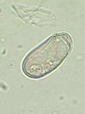 lumbricoides and C. sinensis eggs still perfectly intact even after several hundreds of years [9,25] (Fig. 3E, F).