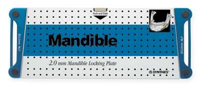 2.0 mm Mandible Locking Plate System Titanium Screws for 2.0 mm Mandible Locking Plates Screws with PlusDrive Recess 401.041 2.0 mm Titanium Cortex Screws, self-tapping, 401.