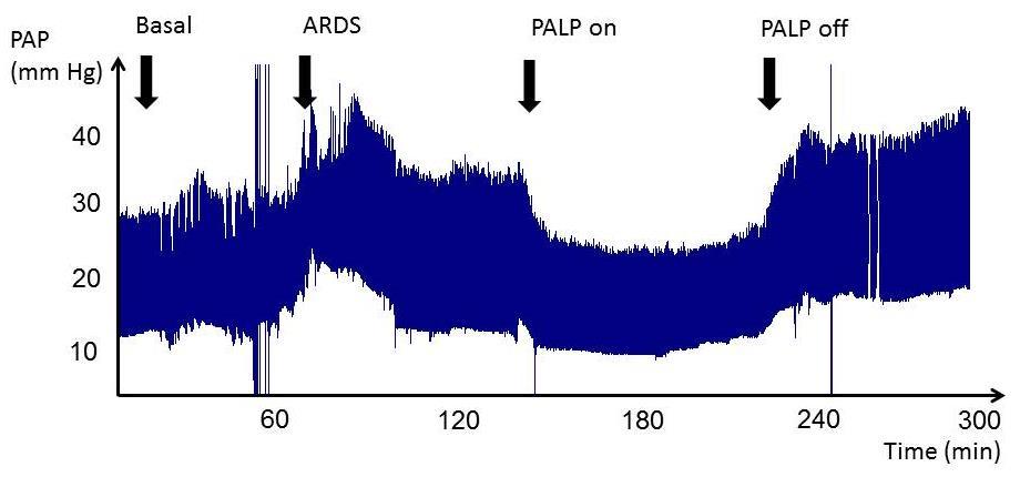 Hemodynamics probes: Baseline ARDS created ARDSnet ventilation