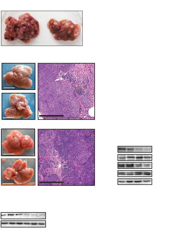 Gui Y et al. SOCS1 controls MET-mediated HCC cell invasion A Hepa-V Hepa-SOCS1 60 P = 0.02 Hepa-V Hepa-SOCS1 Nodules/liver 40 20 0 B Hepa-V C TN Hepa-V Hepa-SOCS1 0.6 P < 0.