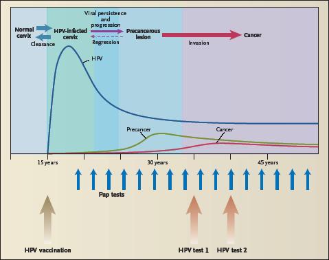 Timeline Effect of HPV Vaccination on Cervical Cancer: The Promise