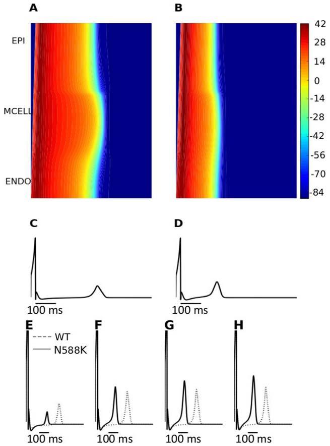 Figure 7. Space-time plot of AP propagation along a 1D transmural ventricular strand and computed pseudo-ecgs.