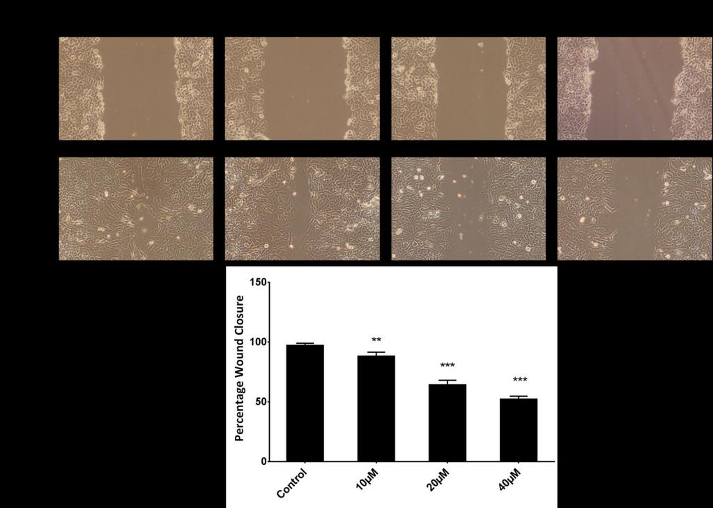 Safranal inhibits the migration and invasion of human oral by overcoming epithelialmesenchymal transition Safranal suppresses the migration of HSC-3 oral To determine whether safranal can inhibit