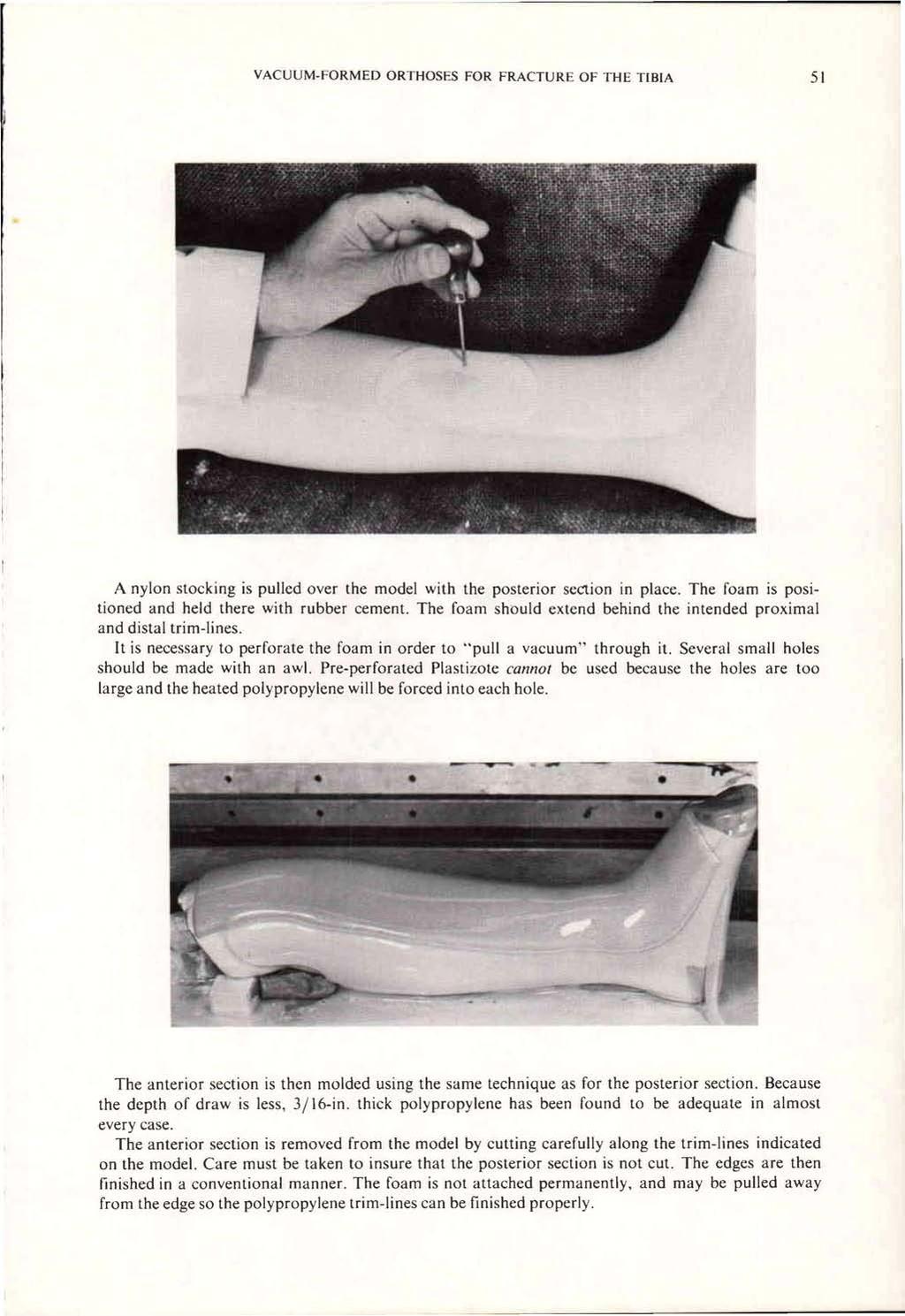 A nylon stocking is pulled over the model with the posterior section in place. The foam is positioned and held there with rubber cement.