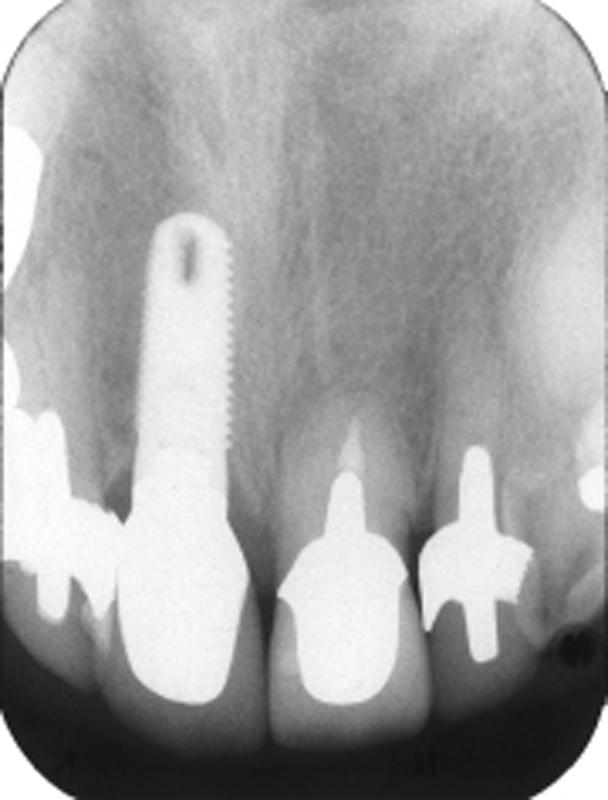 pg. 20 c. Dental X-ray Fig.