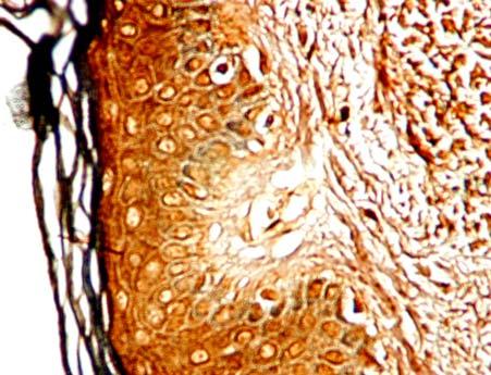 fibers from the papillary dermis.
