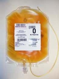 Platelet Donations Very Short shelf-life <5 days Stored at 22 C under agitation ~ 25,000 Platelet units/year Studies by