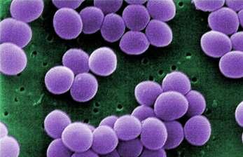 Contamination with bacteria present on the