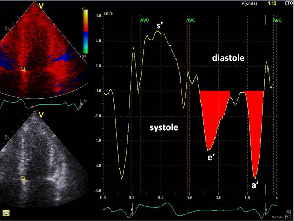 de Knegt et al. Cardiovascular Ultrasound (2016) 14:41 Page 4 of 14 Fig.