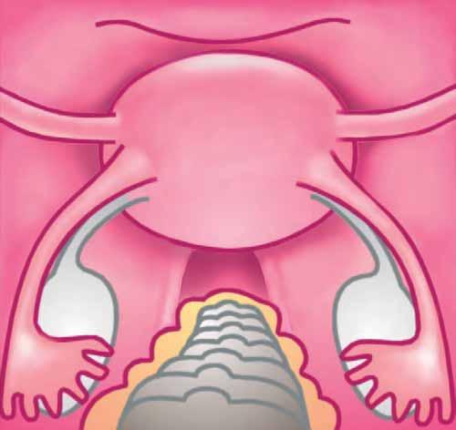 Anatomy The inner organs of the female pelvis as seen from the umbilicus Bladder