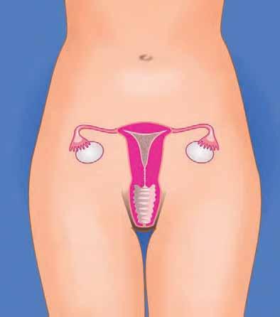 uterus, fallopian tube,