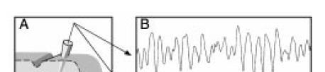 4.6 Oscillations as a prerequisite for synchrony Figure 4.1 illustrates an oscillatory response which was recorded from the visual cortex of an adult cat.