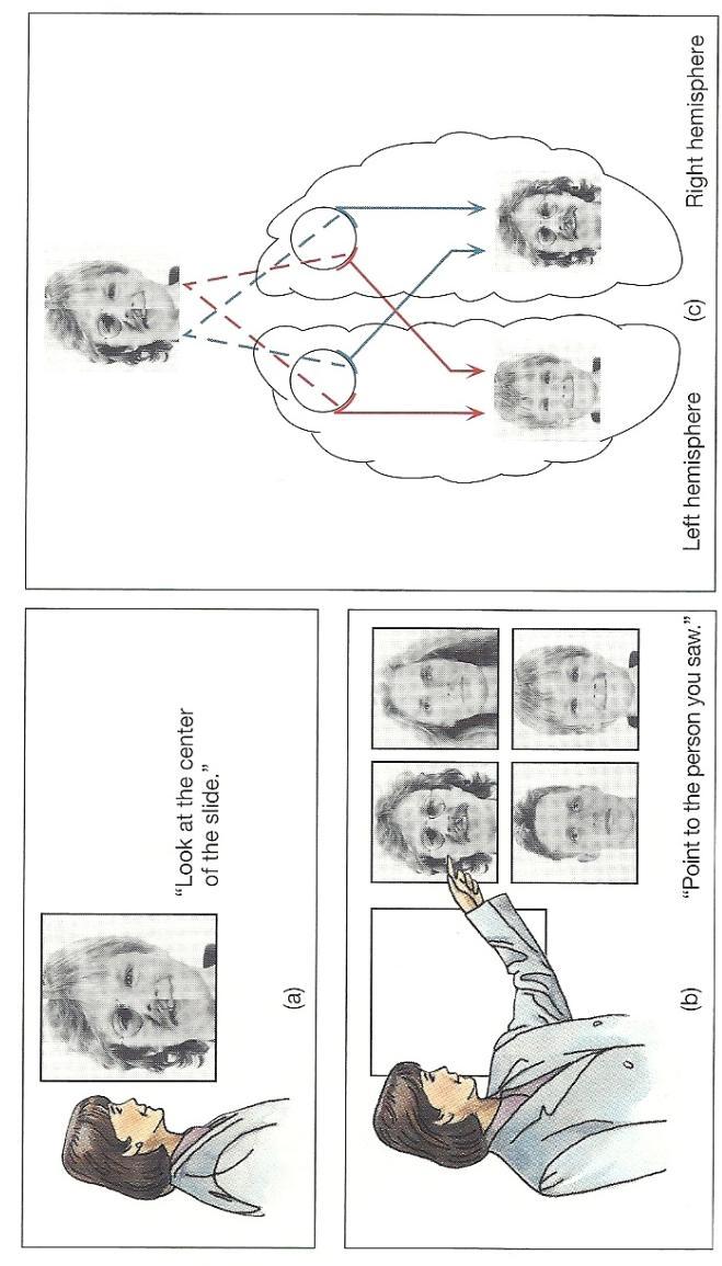 Split Brain: Shown composite of photo (a) asked to pick out the face seen from series of photos (b); Stated; seen face on right side of composite; Yet, pointed with