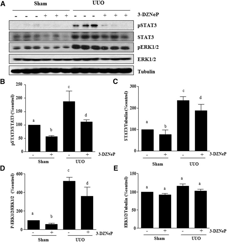 BASIC RESEARCH Figure 11. 3-DZNeP reduces phosphorylation of STAT3 and ERK1/2 in obstructed kidneys.