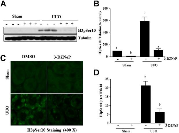 cellular and molecular mediators, 2,3 inhibition of activation and expression of multiple signaling pathways involved in fibrogenesis by targeting EZH2 would have therapeutic potential for treatment