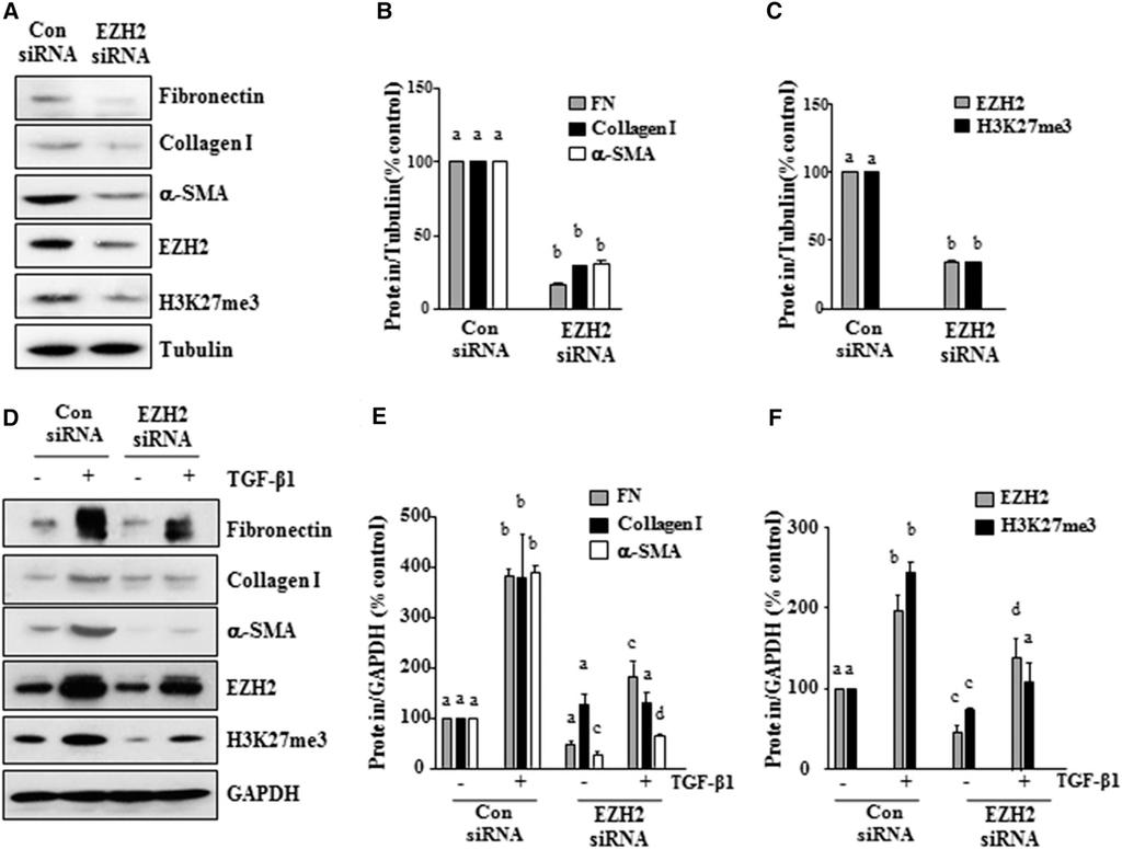 inhibited both basal level and TGFb1-induced expressions of a-sma, collagen I, and fibronectin.