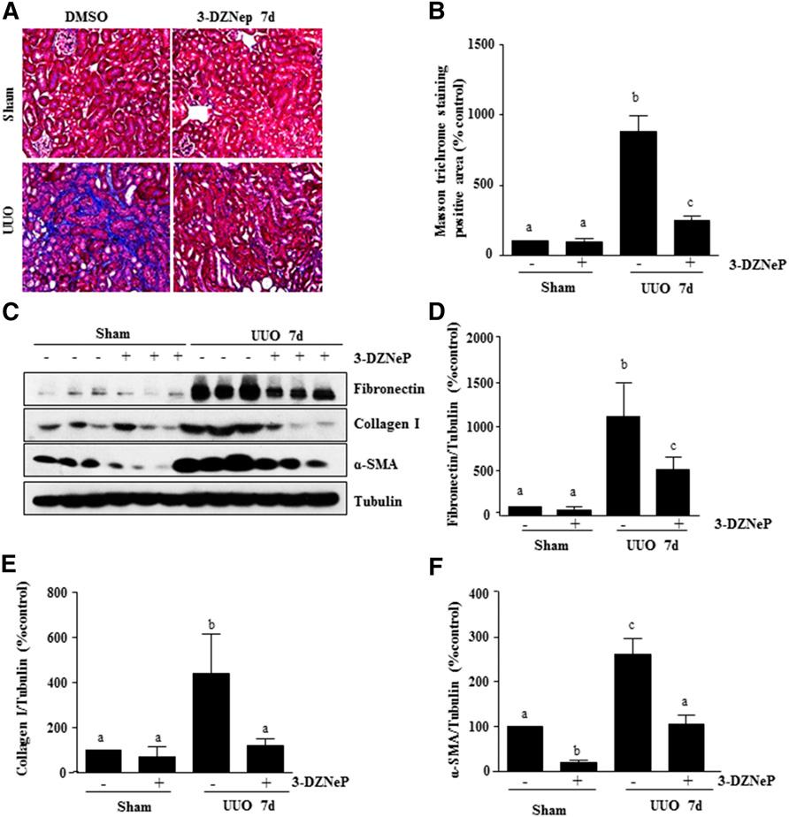 BASIC RESEARCH of 3-DZNeP on renal interstitial fibroblasts and further suggest that EZH2 is involved in the regulation of renal fibroblast activation and the production of ECM proteins.