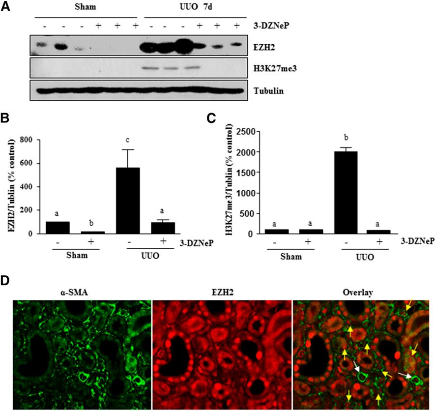 Figure 6. 3-DZNeP effectively inhibits histone methylation in obstructed kidneys.