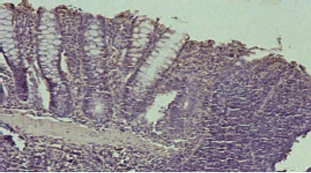 Deferoxamine, ferric citrate and PGN (a TLR-2 ligand) were unable to modify hepcidin expression in these human colon cells (Figure 4).