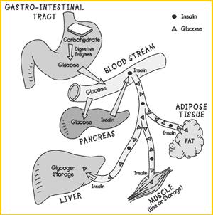 IMPAIRED GLUCOSE REGULATION 1. The pancreas makes little or no insulin, or is unable to use insulin efficiently. 2.