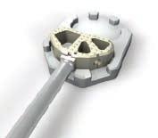SEMIAL product information Implant and Instrument Set Semial implants and instrumentation are designed to provide the spine surgeon with the highest quality, easy to use and cost effective system for