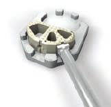 ) Instruments Attachment sites (on templates and implants) for securing the Introducer at 0 or 45 angles Art. No.
