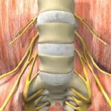 SEMIAL Anterior Lumbar Interbody Fusion A Guide to the Surgical Technique Surgical Approach The procedure is performed under general anesthesia, with the patient placed in a supine position on the