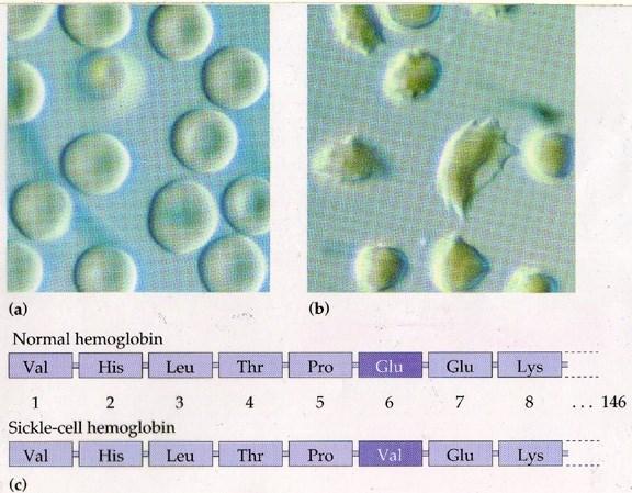 Shape of Protein and Health Hemoglobin and Sickle