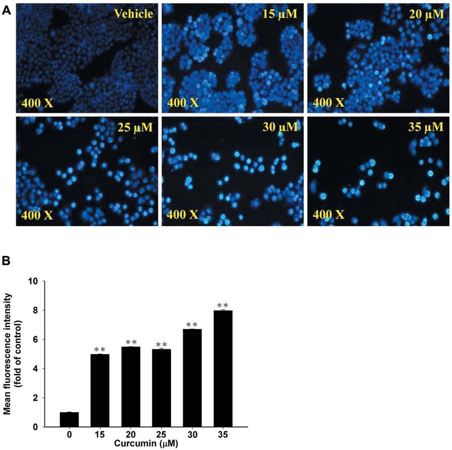 Figure 3. The effects of curcumin on the nuclear morphology in NCI-H460 cells. Cells were treated with 0, 15, 20, 25, 30 and 35 μm in 0.1% DMSO for 24 h.