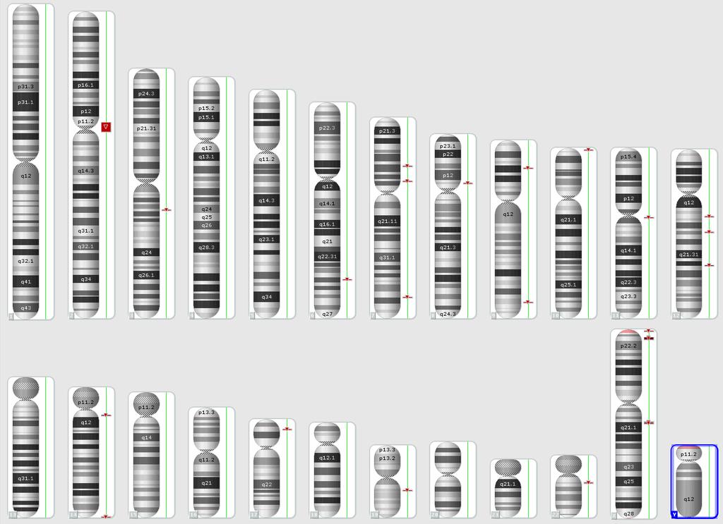 Example: Clinically relevant copy number alterations may all be cytogenetically cryptic 46,XY[25].