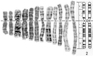 Standard Karyotyping G-banding (Giemsa) chromosomes in metaphase Benefits: Viewing entire genome Can visualize individual cells and individual