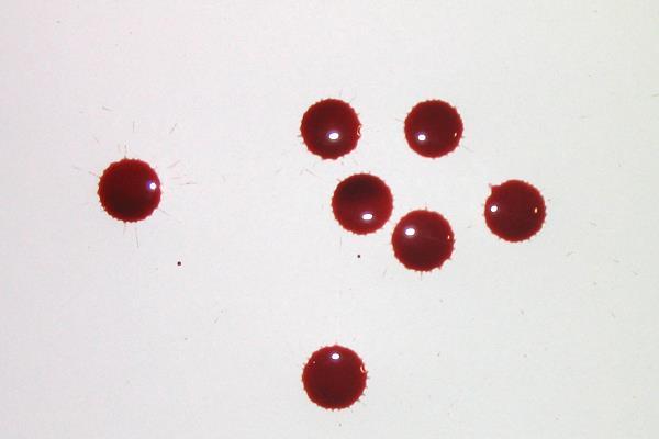 Blood Spatter Analysis In 1902, Dr.