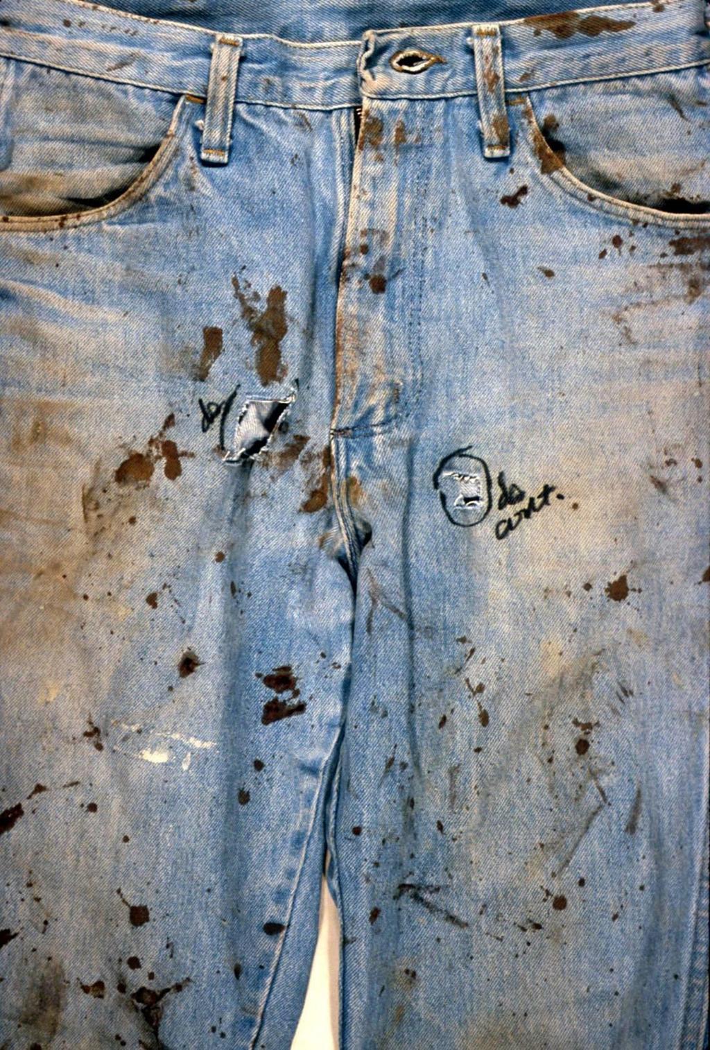Blood Stains on Victim s Jeans Sections removed &