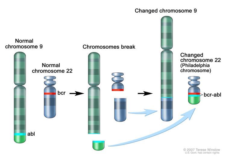 Chimeric transcripts Does the tumoral cells express