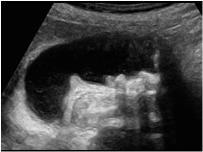 Ultrasound is also used to examine the Uterus and Ovaries, Abdomen and Gallbladder, Heart and Blood Vessels and other organs.