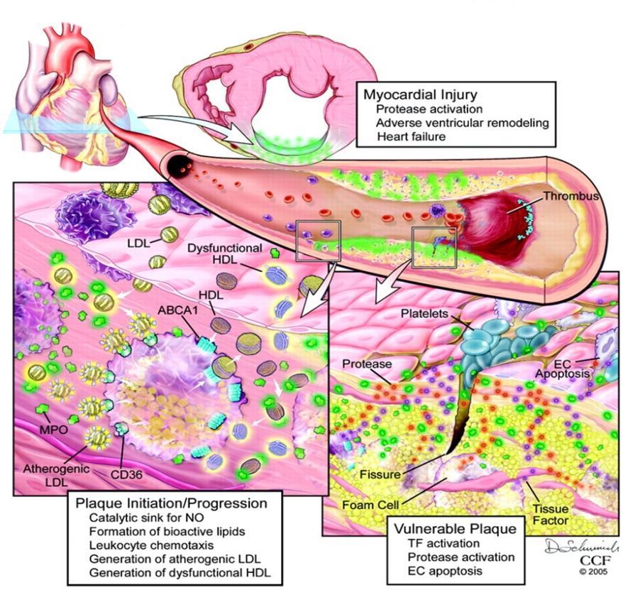 Introduction Myeloperoxidase and atherosclerosis The close relation between MPO activity and cardiovascular diseases prompted the study of the roles of MPO in atherosclerosis.