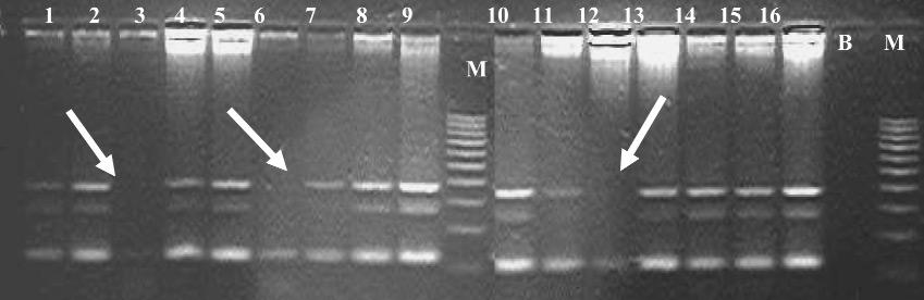 J.Cell.Mol.Med. Vol 7, No 1, 2003 Fig. 2 Example of Multiplex PCR: lane M length marker Sigma 100 pb DNA ladder, lane B sample without DNA, lane 3,6,12 AZFc deleted patients.