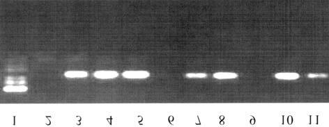 166 Rima Dada, N P Gupta and K Kucheria Figure 2. Gel photograph showing microdeletion of sy254.